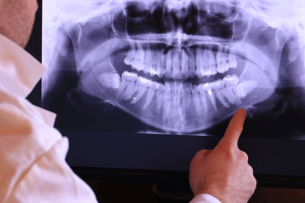 Best Pediatric Emergency Dentist in Frederick, OK