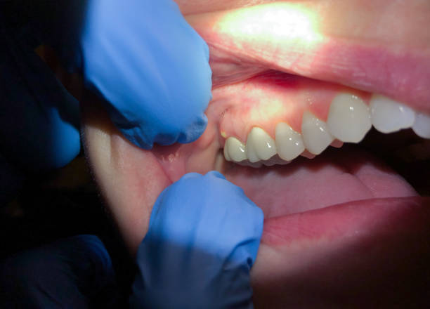 Best Broken or Cracked Tooth Emergency Dentist in Frederick, OK